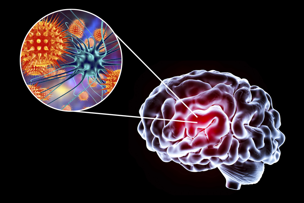 New Nipah Virus antigens now available from The Native Antigen Company