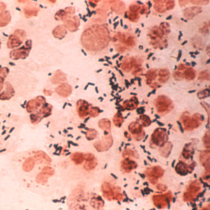 Neisseria gonorrhoeae antigen - The Native Antigen Company