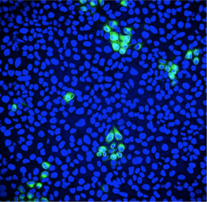 Visualising viral infection with immunofluorescence microscopy - The ...