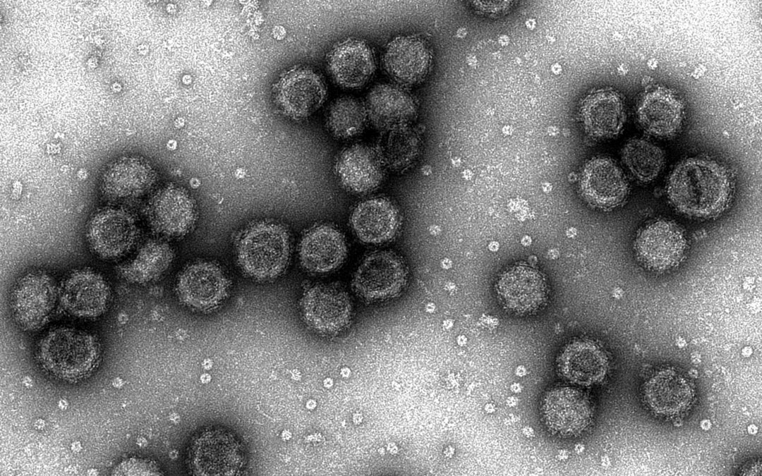 TEM images of our virus-like particles