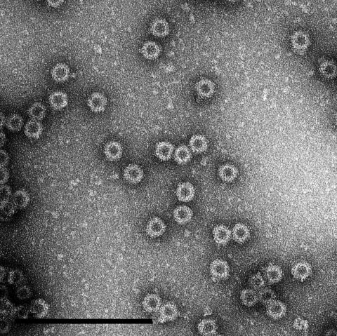 TEM images of our virus-like particles - The Native Antigen Company