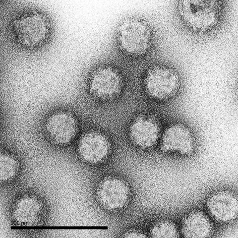 TEM images of our virus-like particles - The Native Antigen Company