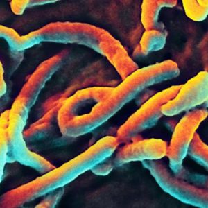 Ebola Virus Nucleoprotein (NP) (Zaire)