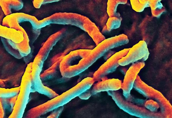 Ebola Virus Nucleoprotein (NP) (Zaire)