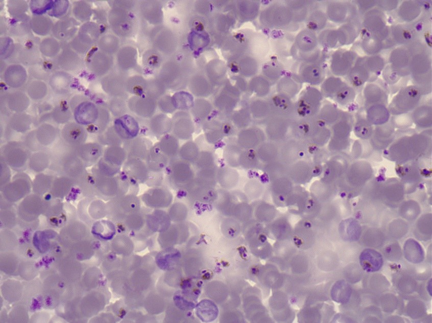 Plasmodium malária antigének