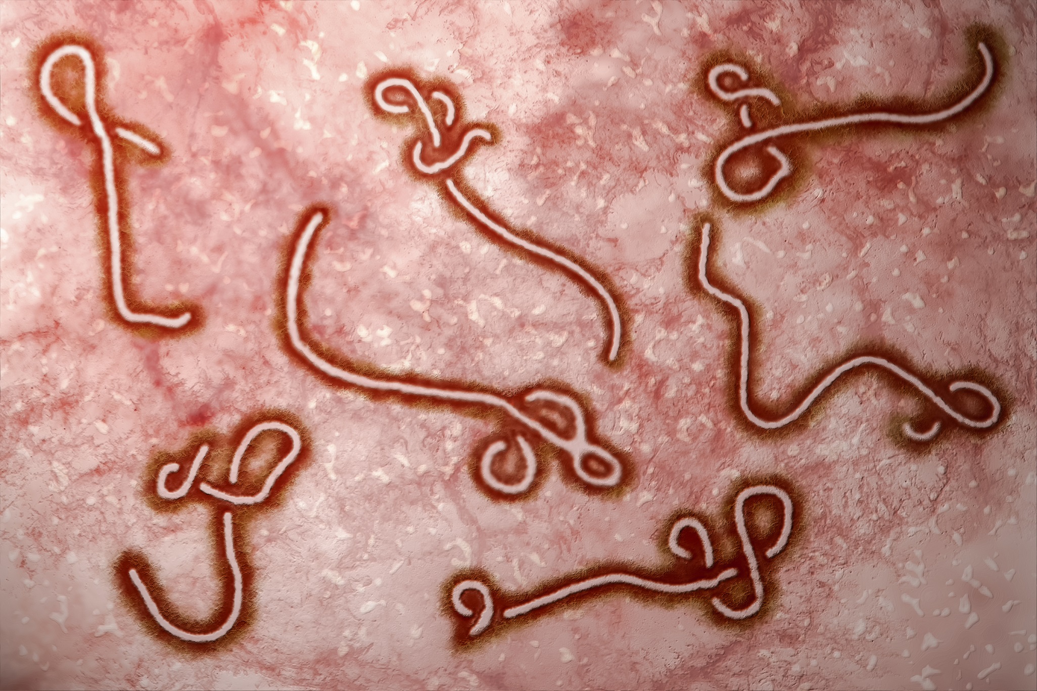 [Hình: Ebola-9-s.jpg]