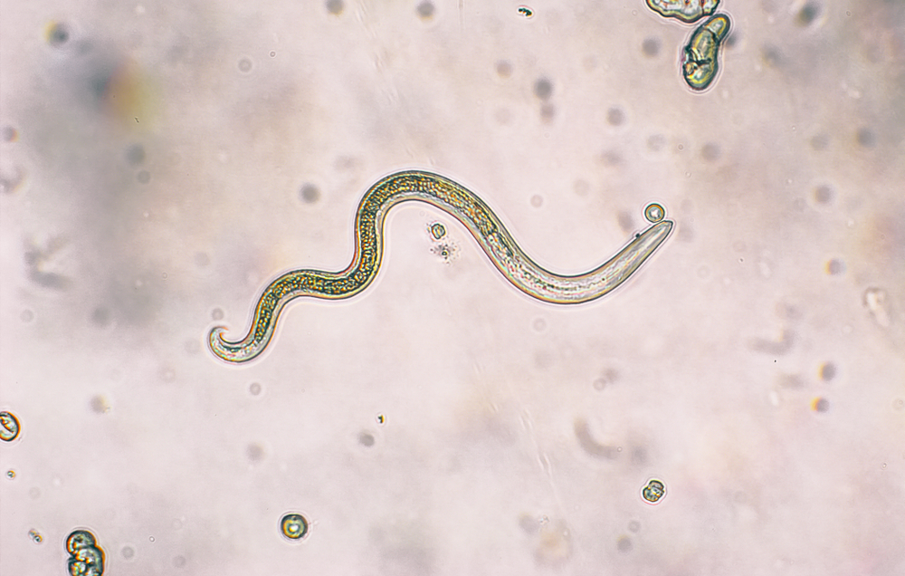 Toxocara parasite