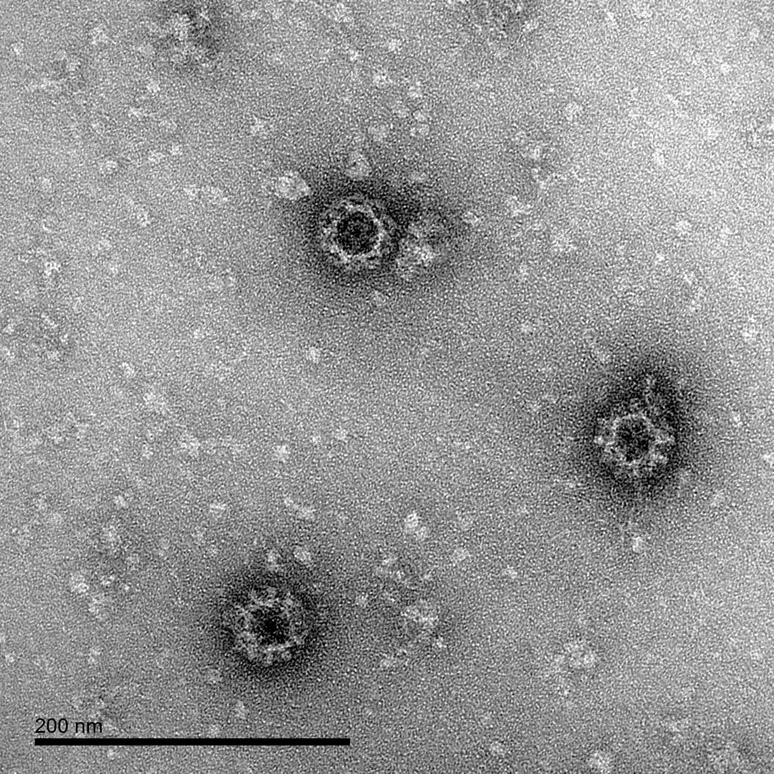 O'Nyong'Nyong Virus-Like Particles