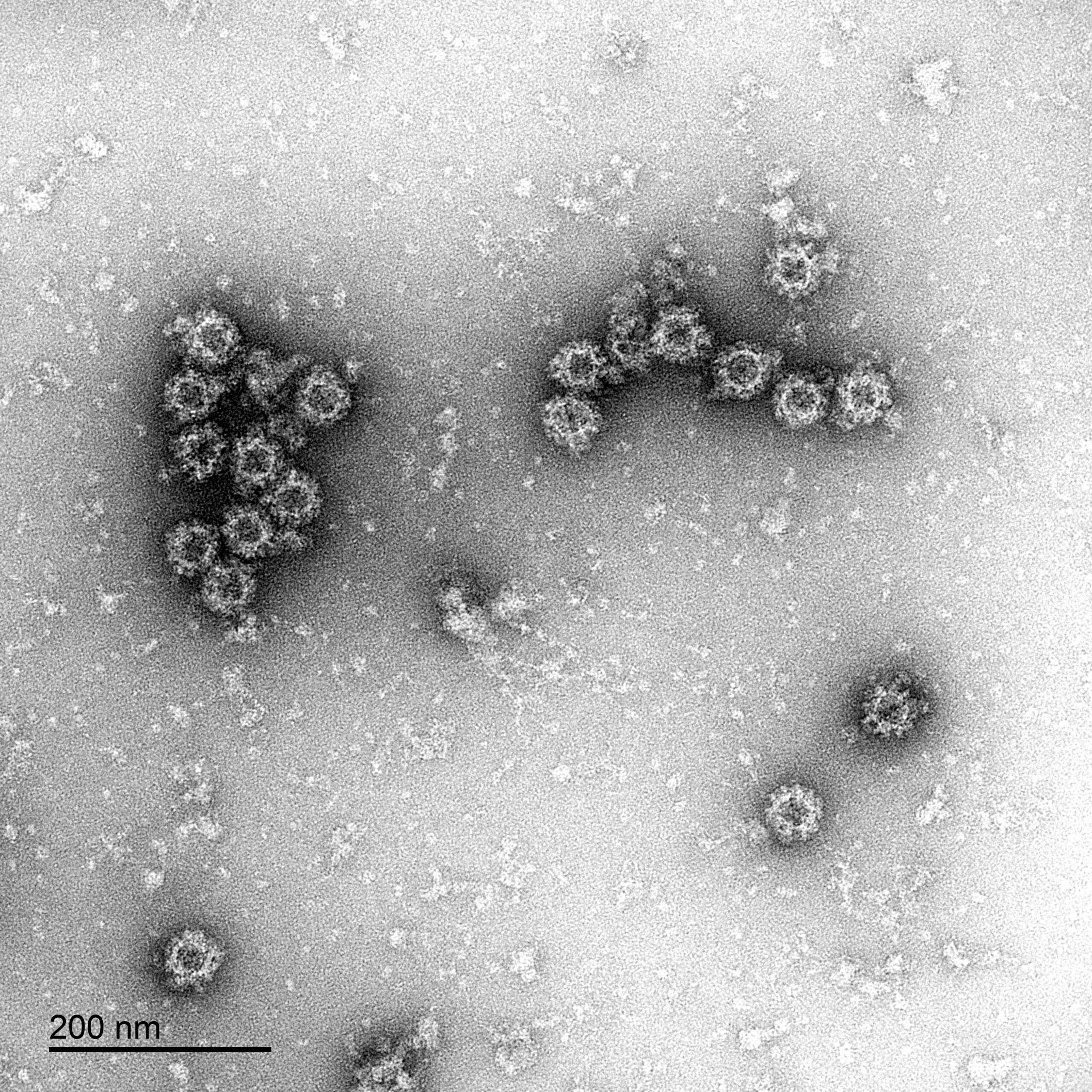 Norovirus Electron Micrograph