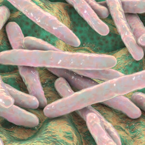 Escherichia coli O145