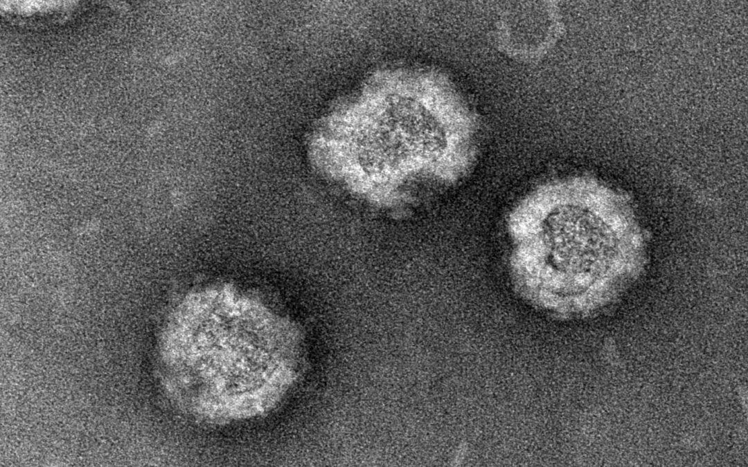 Virus-like particles – the new candidate of choice for diagnosing and preventing rubella
