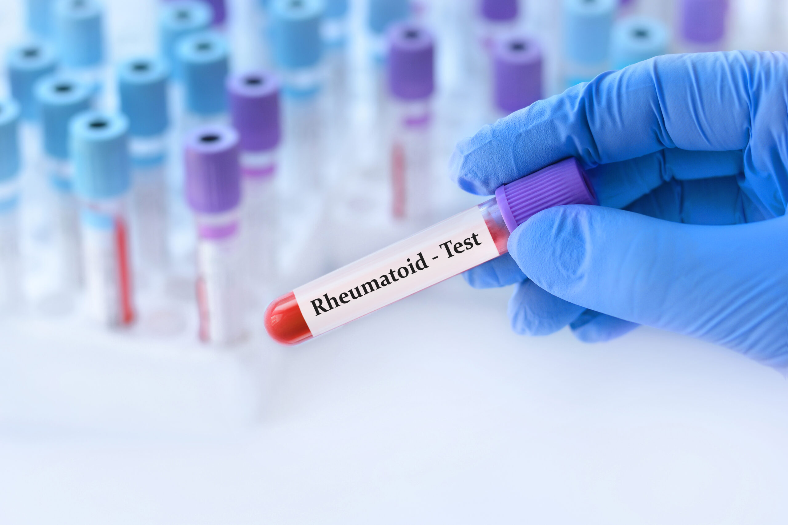 Virology testing services